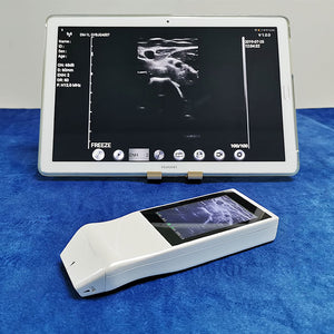 Each participant attempted ultrasound-guided peripheral venous access on a pediatric ... Wearable electronic devices Ultrasonography Wireless technology ... especially when used in conjunction with tools such as wireless ultrasound