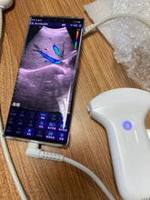 Load image into Gallery viewer, Ultrasound scanner Color Probe For PC USB/Wireless Handheld Convex ... FDA CE Portable Digital Ultrasound Scanner System w/ 3.5Mhz Convex Probe
