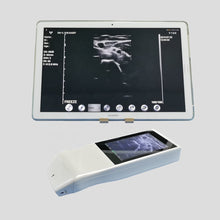 Load image into Gallery viewer, Wifi wireless Ultrasound Scanner-Guided Vascular Access Tool Color Imaging
