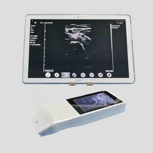 Wifi wireless Ultrasound Scanner-Guided Vascular Access Tool Color Imaging