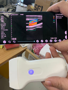 Vascular ultrasound machine 