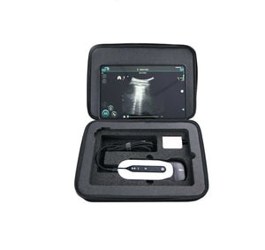 Ultrasound Probe For tablet/ Phone / USB/Wireless Linear Ultrasound Scanner Transcare-scan-6.7